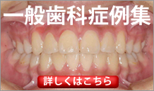 一般歯科症例
