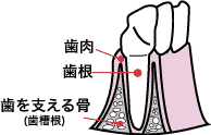 歯周病1